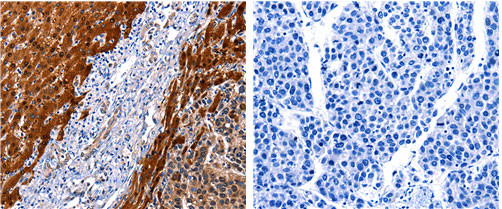 Cullin 4A Antibody in Immunohistochemistry (Paraffin) (IHC (P))