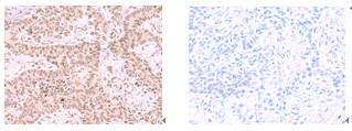 MCMBP Antibody in Immunohistochemistry (Paraffin) (IHC (P))