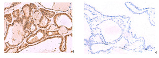 MCMBP Antibody in Immunohistochemistry (Paraffin) (IHC (P))