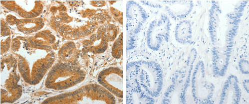 AKR1C1 Antibody in Immunohistochemistry (Paraffin) (IHC (P))