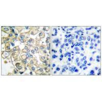 FGFR1OP Antibody in Immunohistochemistry (Paraffin) (IHC (P))