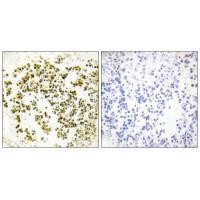 MSC Antibody in Immunohistochemistry (Paraffin) (IHC (P))