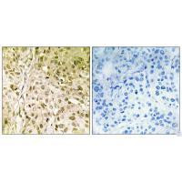 POLQ Antibody in Immunohistochemistry (Paraffin) (IHC (P))