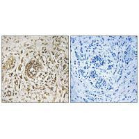 KIP2 Antibody in Immunohistochemistry (Paraffin) (IHC (P))