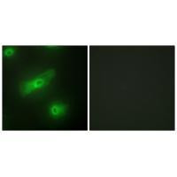 APRIL Antibody in Immunocytochemistry (ICC/IF)