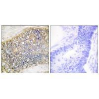 APRIL Antibody in Immunohistochemistry (Paraffin) (IHC (P))