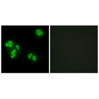 TNFAIP8 Antibody in Immunocytochemistry (ICC/IF)