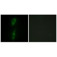 ACVRL1 Antibody in Immunocytochemistry (ICC/IF)