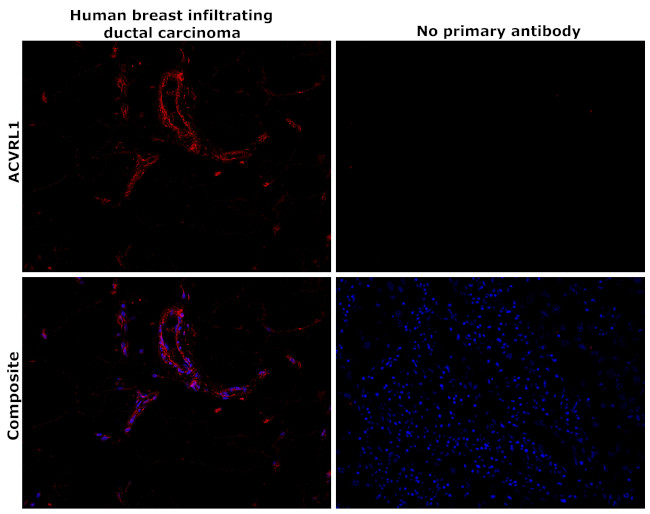 ACVRL1 Antibody in Immunohistochemistry (Paraffin) (IHC (P))