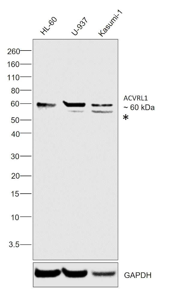 ACVRL1 Antibody in Western Blot (WB)