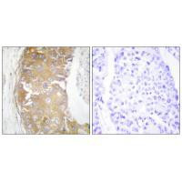 FRK Antibody in Immunohistochemistry (Paraffin) (IHC (P))