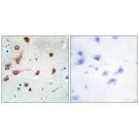 ADAR Antibody in Immunohistochemistry (Paraffin) (IHC (P))