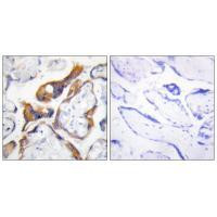 PHLDA2 Antibody in Immunohistochemistry (Paraffin) (IHC (P))