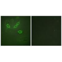 TUSC5 Antibody in Immunocytochemistry (ICC/IF)