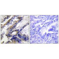 ILKAP Antibody in Immunohistochemistry (Paraffin) (IHC (P))