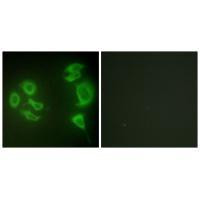 ZAK Antibody in Immunocytochemistry (ICC/IF)