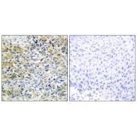 CARKL Antibody in Immunohistochemistry (Paraffin) (IHC (P))