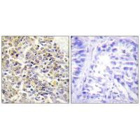 PYCARD Antibody in Immunohistochemistry (Paraffin) (IHC (P))