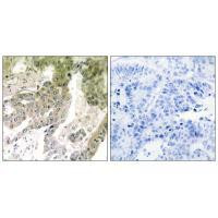 Laminin alpha-5 Antibody in Immunohistochemistry (Paraffin) (IHC (P))