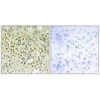 Galectin 8 Antibody in Immunohistochemistry (Paraffin) (IHC (P))