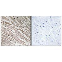 MRPL44 Antibody in Immunohistochemistry (Paraffin) (IHC (P))