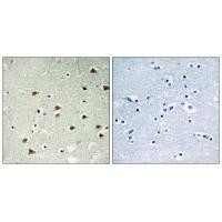 ABHEB Antibody in Immunohistochemistry (Paraffin) (IHC (P))