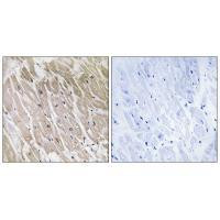 ACAD10 Antibody in Immunohistochemistry (Paraffin) (IHC (P))