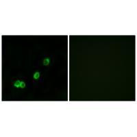 ACOT1 Antibody in Immunocytochemistry (ICC/IF)