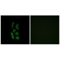 ACOT12 Antibody in Immunocytochemistry (ICC/IF)