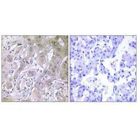 ACOT12 Antibody in Immunohistochemistry (Paraffin) (IHC (P))