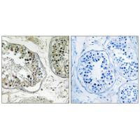 CHST13 Antibody in Immunohistochemistry (Paraffin) (IHC (P))