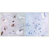 CHSY1 Antibody in Immunohistochemistry (Paraffin) (IHC (P))