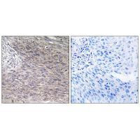 CHPF Antibody in Immunohistochemistry (Paraffin) (IHC (P))