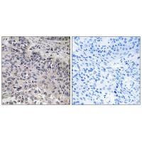 C1QC Antibody in Immunohistochemistry (Paraffin) (IHC (P))