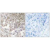 NCAPG2 Antibody in Immunohistochemistry (Paraffin) (IHC (P))