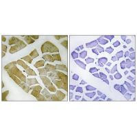 Myosin 4 Antibody in Immunohistochemistry (Paraffin) (IHC (P))