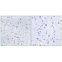 NPHP4 Antibody in Immunohistochemistry (Paraffin) (IHC (P))