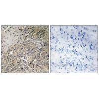 A26C2/A26C3 Antibody in Immunohistochemistry (Paraffin) (IHC (P))