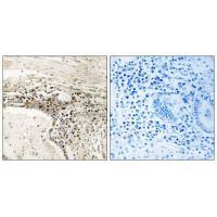 SSH3 Antibody in Immunohistochemistry (Paraffin) (IHC (P))