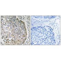 MRRF Antibody in Immunohistochemistry (Paraffin) (IHC (P))