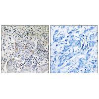 SESN1 Antibody in Immunohistochemistry (Paraffin) (IHC (P))