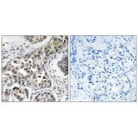 USP6NL Antibody in Immunohistochemistry (Paraffin) (IHC (P))