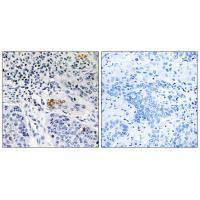 ZBTB40 Antibody in Immunohistochemistry (Paraffin) (IHC (P))