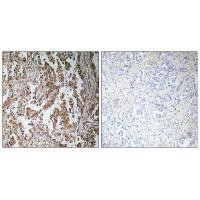 TBPL2 Antibody in Immunohistochemistry (Paraffin) (IHC (P))