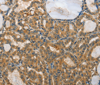 MPS1 Antibody in Immunohistochemistry (Paraffin) (IHC (P))