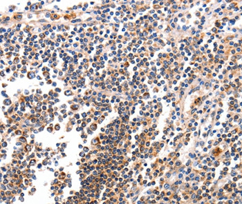 BCL2L15 Antibody in Immunohistochemistry (Paraffin) (IHC (P))