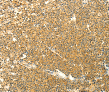 AARS2 Antibody in Immunohistochemistry (Paraffin) (IHC (P))