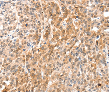 Annexin A8 Antibody in Immunohistochemistry (Paraffin) (IHC (P))