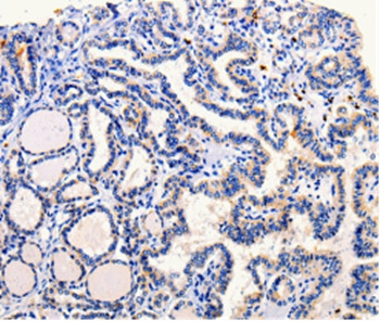 ARL6 Antibody in Immunohistochemistry (Paraffin) (IHC (P))