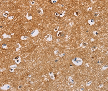 Calpain 7 Antibody in Immunohistochemistry (Paraffin) (IHC (P))